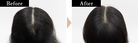 長岡さんBefore/AFter